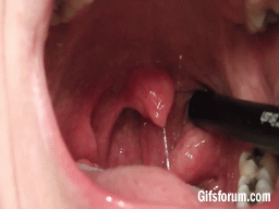BB7A78E2-F609-42FC-9E4C-697FE8A636D0.gif