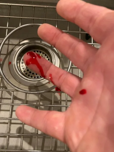 blood.webp